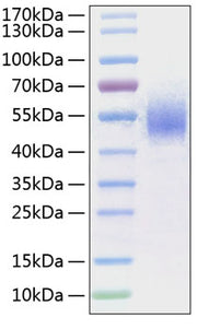 Recombinant Human Fc gamma RI/FCGR1/CD64 Protein