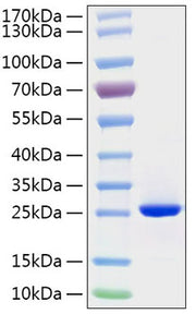 Recombinant Human FGF-19 Protein