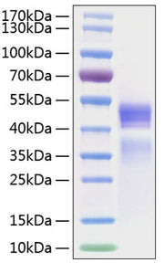 Recombinant Human IL-12/IL-12A&IL-12B Protein