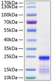 Recombinant Human GTPase KRas/KRAS(G12V) Protein
