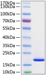 Recombinant Human FGF-1/aFGF Protein