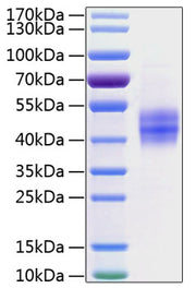 Recombinant Human Follistatin/Follistatin 315/FST Protein