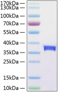 Recombinant Human Siglec-15/CD33L3 Protein