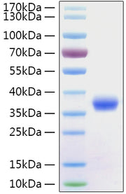Recombinant SARS-CoV-2 Spike RBD  Protein