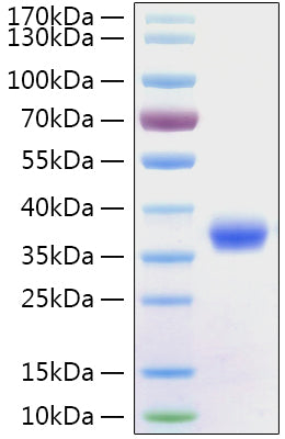 Recombinant SARS-CoV-2 Spike RBD  Protein
