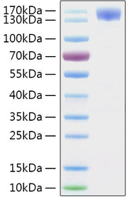 Recombinant SARS-CoV-2 Spike S1 Protein
