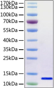 Recombinant SARS-CoV-2 Envelope Protein