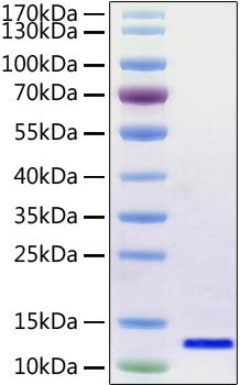 Recombinant SARS-CoV-2 Envelope Protein