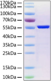 Recombinant SARS-CoV-2 Nucleocapsid Protein