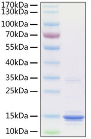 Recombinant Human S100-A9 Protein