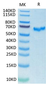 Recombinant SARS-CoV-2 Spike RBD  Protein