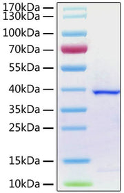 Recombinant SARS-CoV-2 papain-like protease Protein
