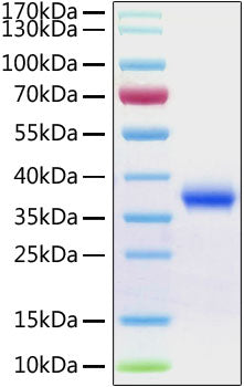 Recombinant SARS-CoV-2 Spike RBD  Protein