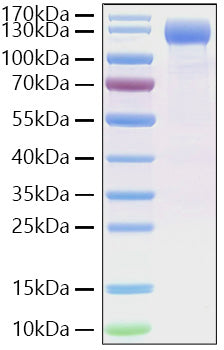 Recombinant SARS-CoV-2 Spike S1(D614G) Protein