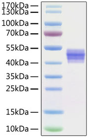 Recombinant Human IL-12B/IL-12 p40 Protein