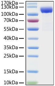 Recombinant Human DPP4/CD26  Protein