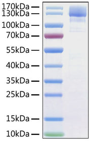 Recombinant SARS-CoV Spike S1 Protein