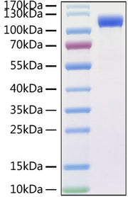 Recombinant SARS-CoV Spike RBD  Protein