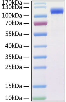 Recombinant SARS-CoV Spike RBD  Protein