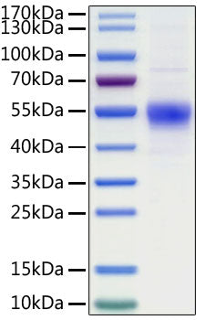 Recombinant Human CD19 Protein