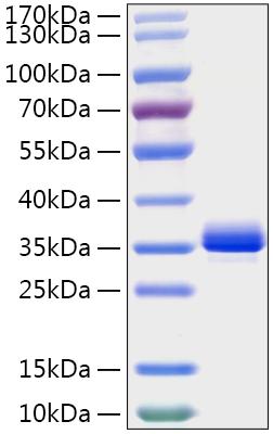 Recombinant Mouse Noggin/NOG Protein