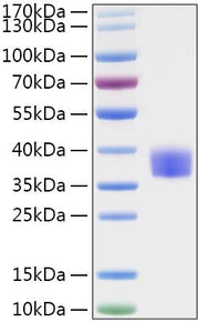 Recombinant MERS-CoV Spike RBD  Protein