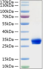 Recombinant Rat VEGF-A/VEGF164 Protein