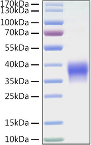 Recombinant Mouse B7-H5/Gi24/VISTA Protein