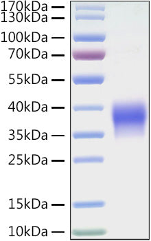 Recombinant Mouse B7-H5/Gi24/VISTA Protein