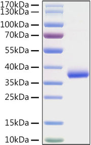 Recombinant SARS-COV-2 Spike RBD(K417N) Protein