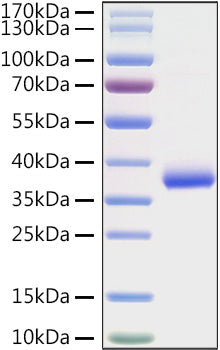 Recombinant SARS-COV-2 Spike RBD(K417N) Protein