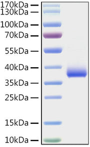 Recombinant SARS-COV-2 Spike RBD(E484K) Protein