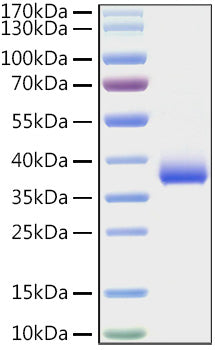 Recombinant SARS-COV-2 Spike RBD(E484K) Protein