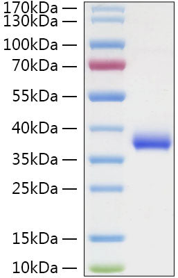 Recombinant SARS-COV-2 Spike RBD(N501Y)  Protein