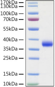 Recombinant SARS-COV-2 Spike RBD(L452R,E484Q)  Protein
