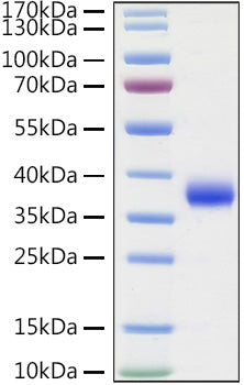 Recombinant SARS-COV-2 Spike RBD(L452R,E484Q)  Protein