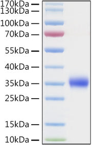 Recombinant Human TIMP-1 Protein