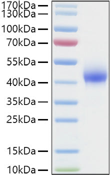 Recombinant Human Dkk-1 Protein