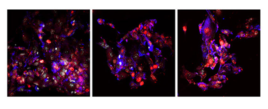 Recombinant Mouse FGF-2/bFGF Protein