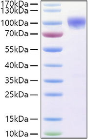 Recombinant Human TNFRSF21/DR6/CD358 Protein