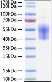 Recombinant Human B7-H6/NCR3LG1 Protein