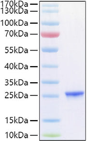 Recombinant Human TIMP-2 Protein