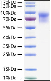 Recombinant Mouse IL-15RA/CD215 Protein