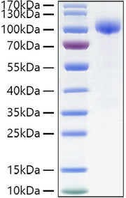 Recombinant Human IL-23R Protein
