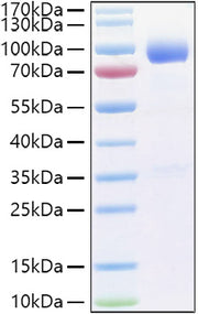 Recombinant Human IL-1R3/IL-1RAcP/IL1RAP Protein