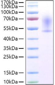 Recombinant Mouse CX3CL1/Fractalkine Protein