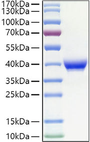 Recombinant Human Fc epsilon RII/CD23 Protein