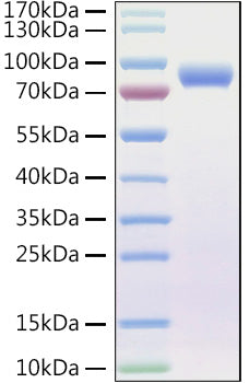Recombinant Human Endoglin/ENG/CD105 Protein