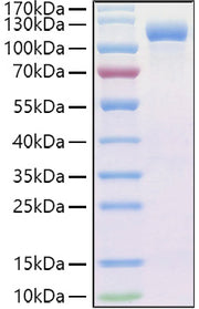 Recombinant Human Endoglin/ENG/CD105 Protein