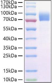 Recombinant Cynomolgus IL-2RG/CD132 Protein